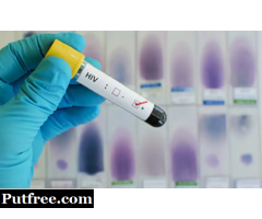 Antibodies test for HIV 1 in Vasant Vihar [+91-8010977000]