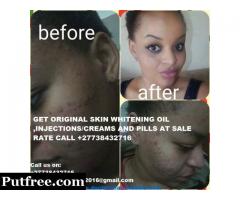 GET ORIGINAL SKIN WHITENING OIL ,INJECTIONS/CREAMS AND PILLS AT SALE RATE CALL +27738432716