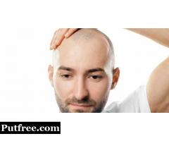 In search of a non-surgical procedure for hair growth?