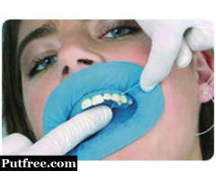 Retain Your Oral Aesthetics and Functionality at the Best Tooth Capping Cost