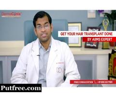 What to Expect from a Hair Transplantation Treatment?