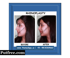 Rhinoplasty Surgery in Delhi by Dr. Ajaya Kashyap - Book Appointment Today!