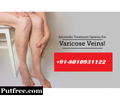 CALL[ [ 801-093-1122 ] ] | Best doctors for varicose veins in New Friends Colony