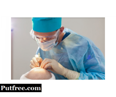 Best hospitals for hair transplant in India