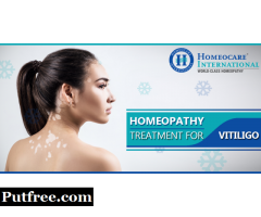 Vitiligo Treatment In Homeopathy