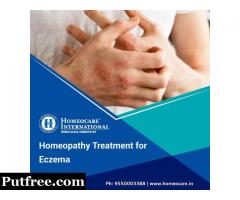 Homeopathic Treatment For Eczema