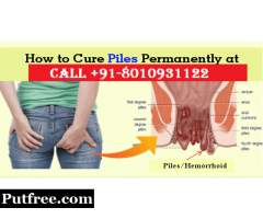 CALL (+91-8010931122 ):- Piles lady doctor in Patel Nagar,Delhi