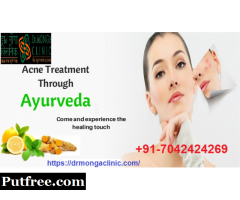 7042424269 -Best ayurvedic skin treatment in Govind Puri