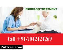 Call:(+91)7042424269:- Psoriasis Treatment in Derawal Nagar