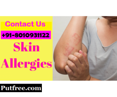 8010931122 || best Skin Allergy Treatment in Faridabad