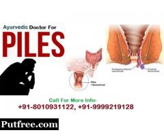 || +91-8010931122 || Piles doctor in Ghaziabad