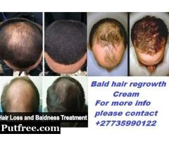 Bald head hair recovery cream +27679005086 USA, UK, Zambia, Namibia, Botswana