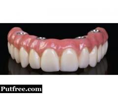 Complete Denture Treatment in Delhi