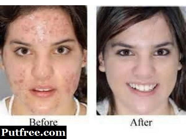 +27785325259 $@Skin lightening creams / gels from Africa,U.S.A,UK